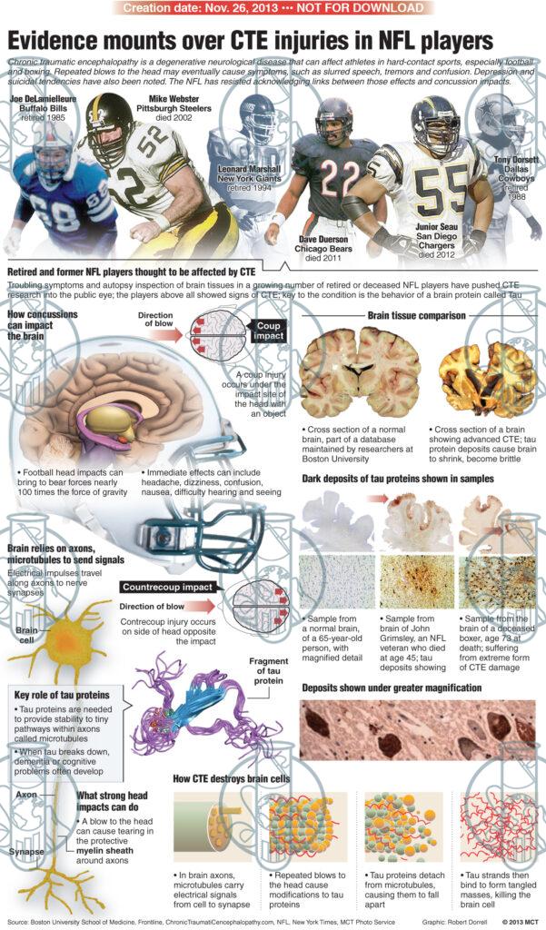 GraphFixLab | CTE NFL players