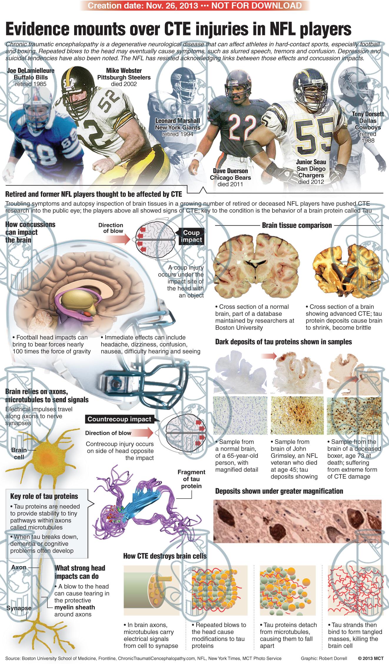 GraphFixLab CTE NFL Players Graphfixlab cte nfl players